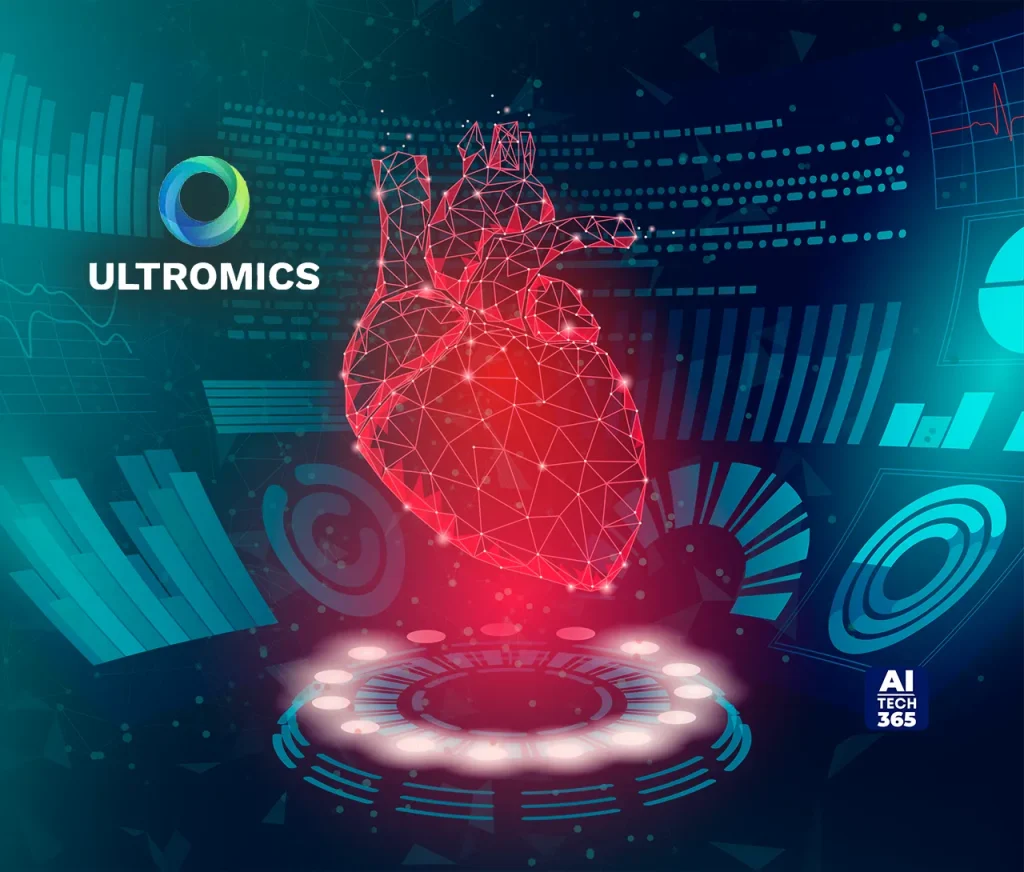 Ultromics