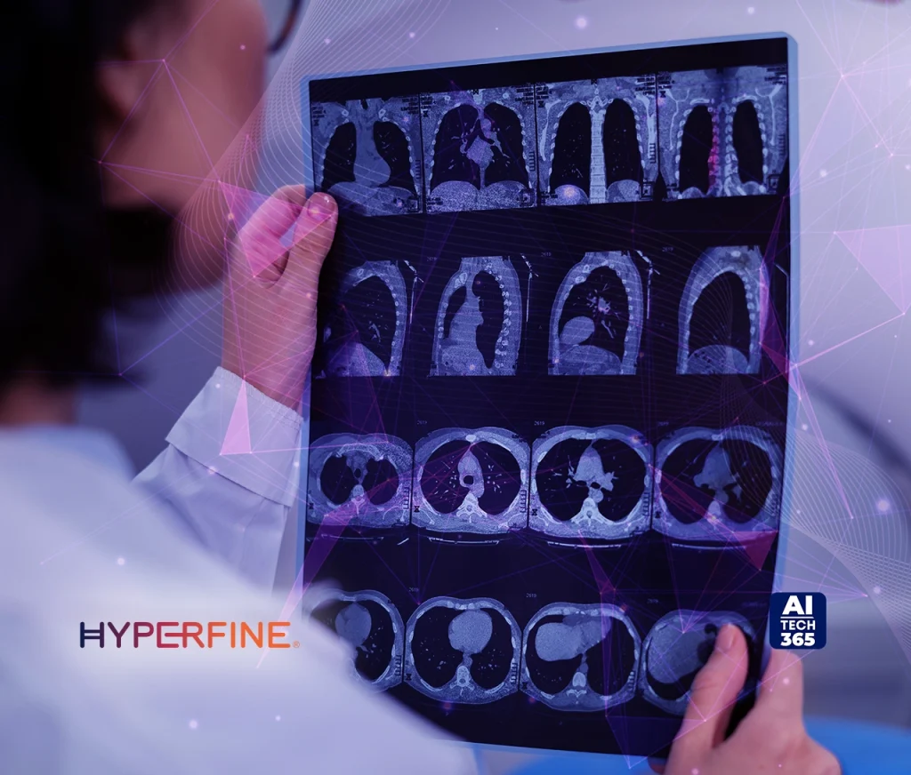 Hyperfine